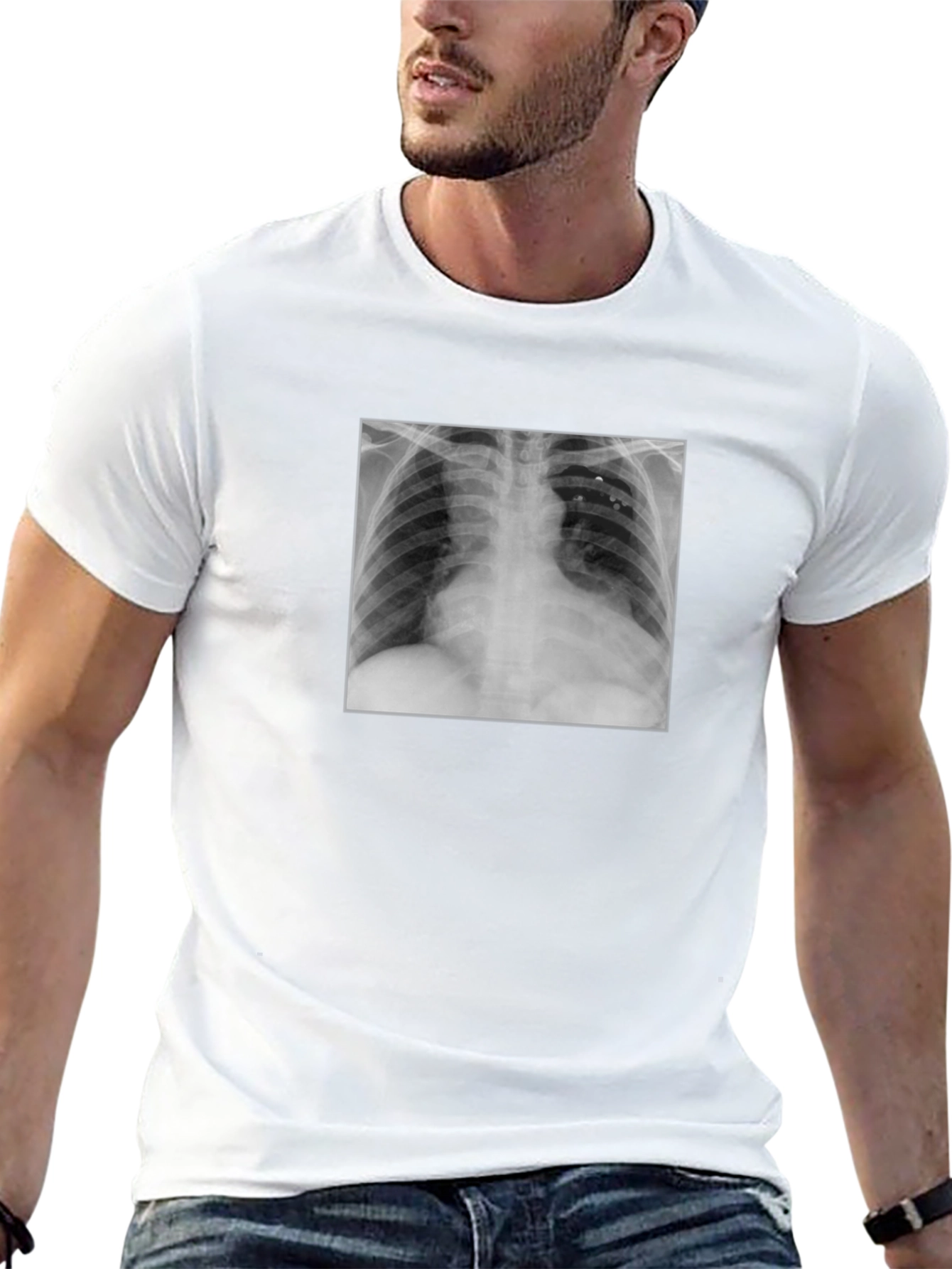 X-Ray Graphic Tee - Medical Humor T-Shirt