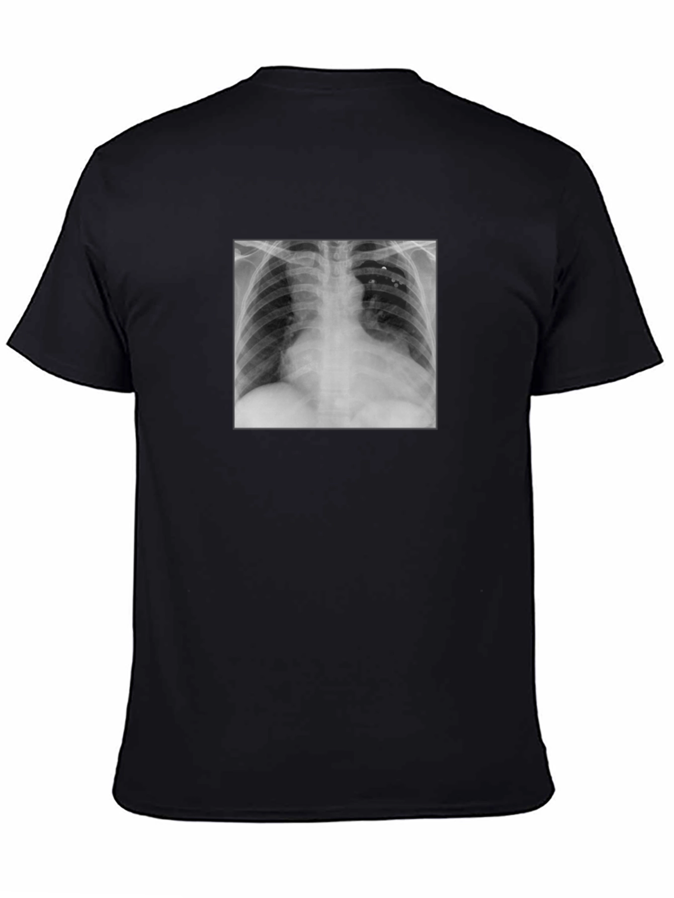 X-Ray Graphic Tee - Medical Humor T-Shirt