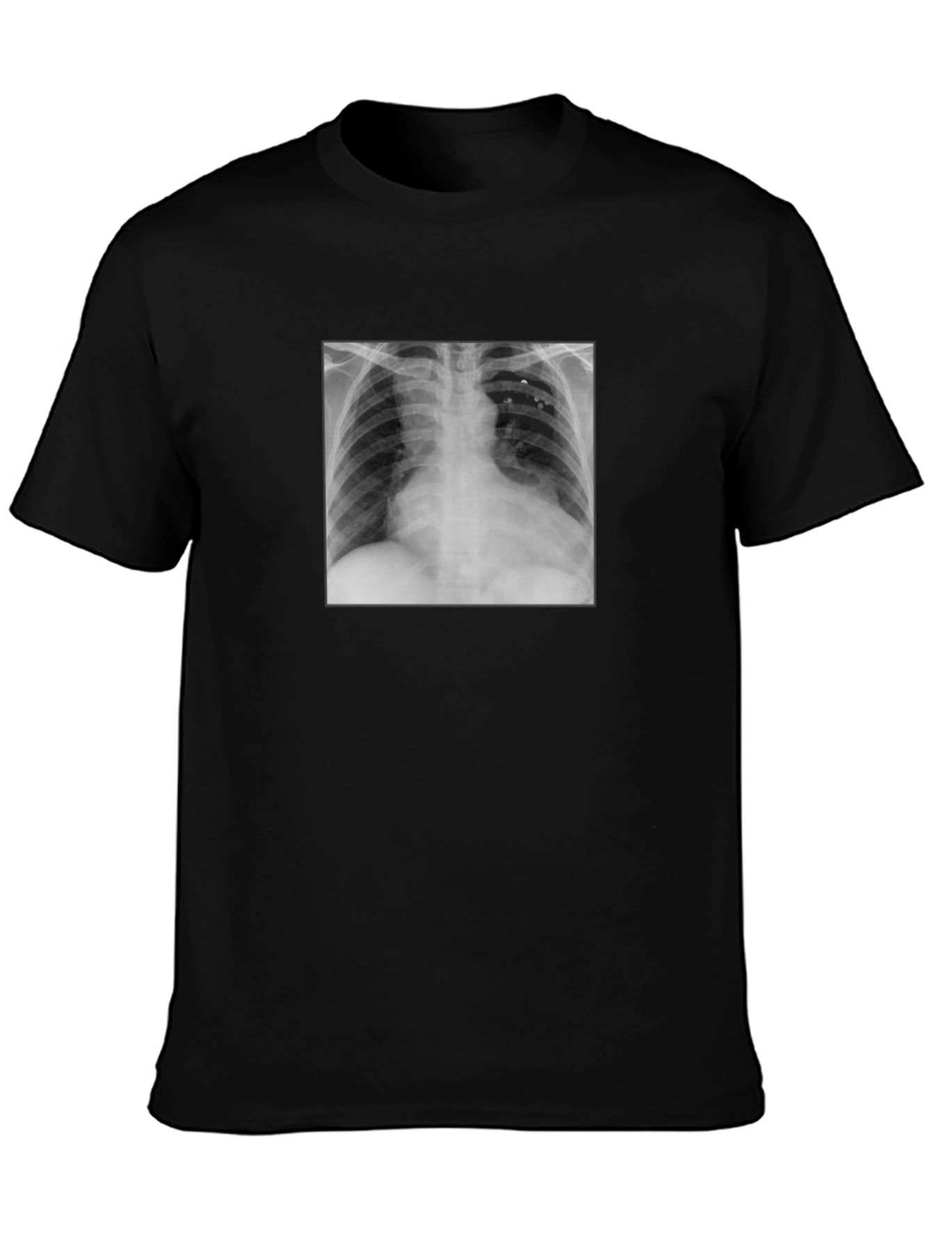 X-Ray Graphic Tee - Medical Humor T-Shirt
