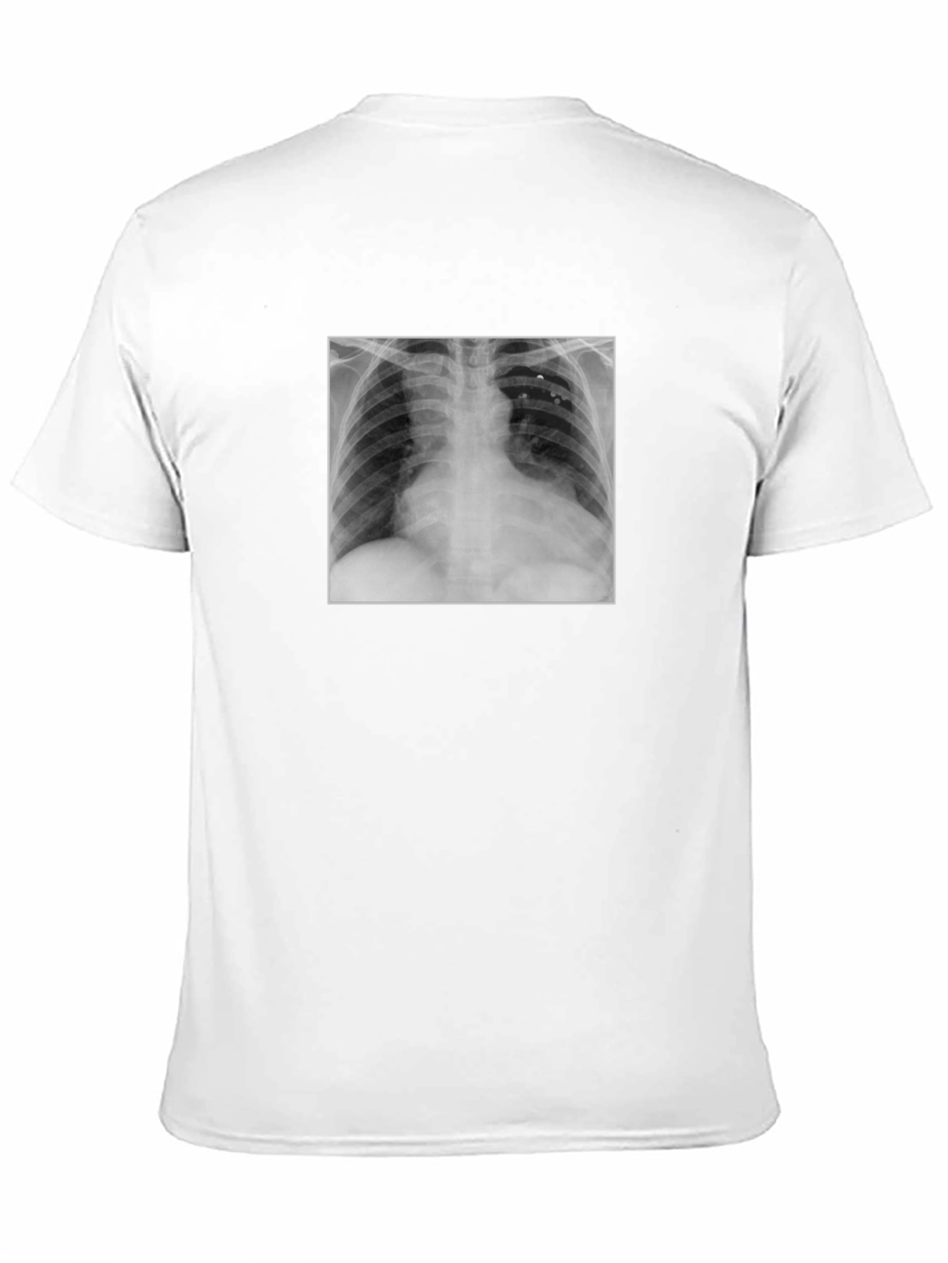 X-Ray Graphic Tee - Medical Humor T-Shirt