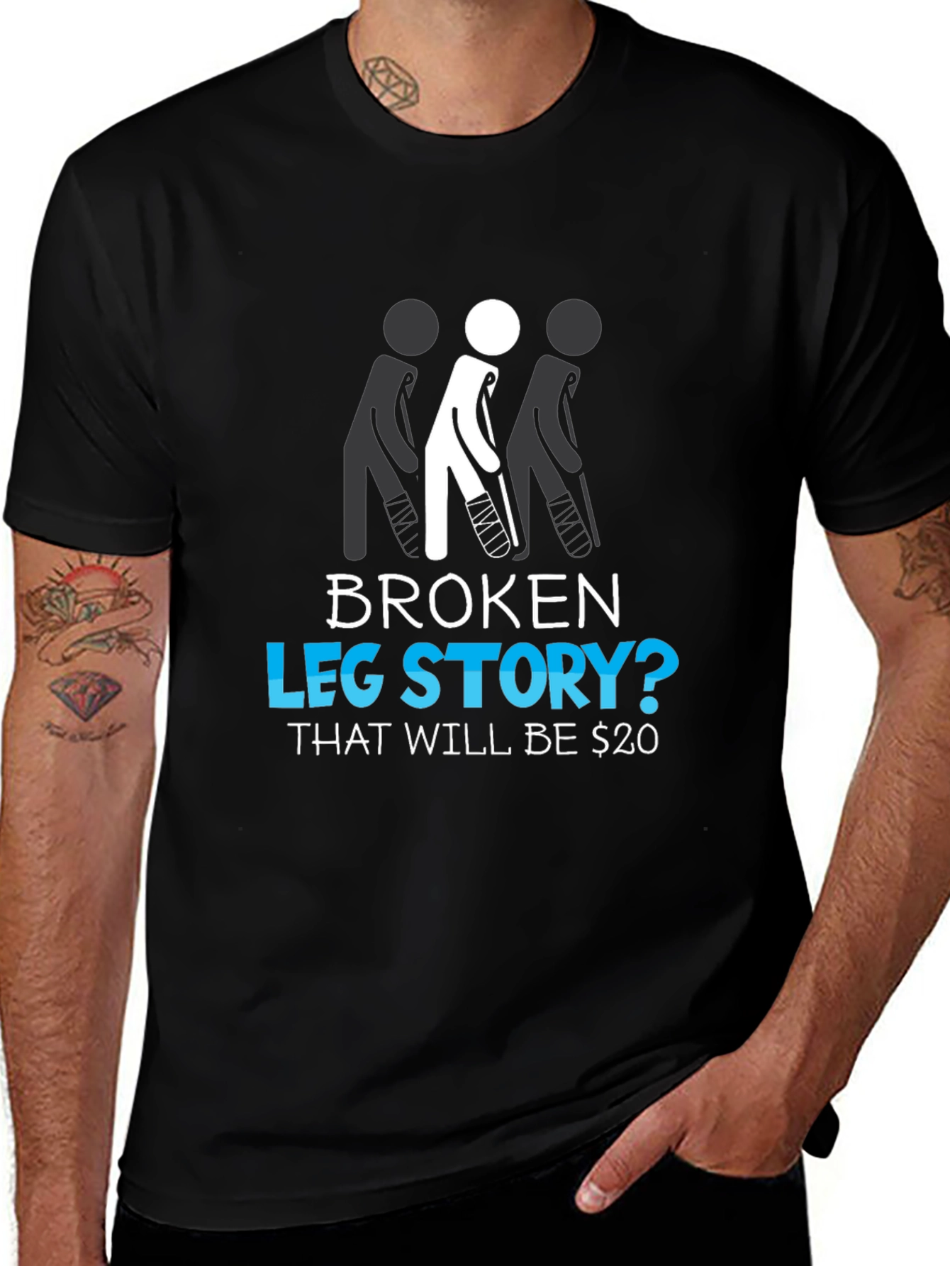 Broken Leg Story? Funny Graphic Tee