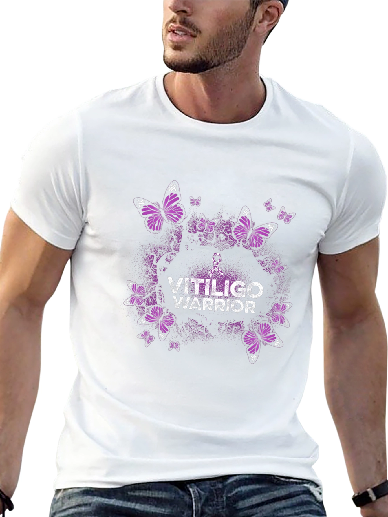 Vitiligo Warrior Butterfly Graphic Tee