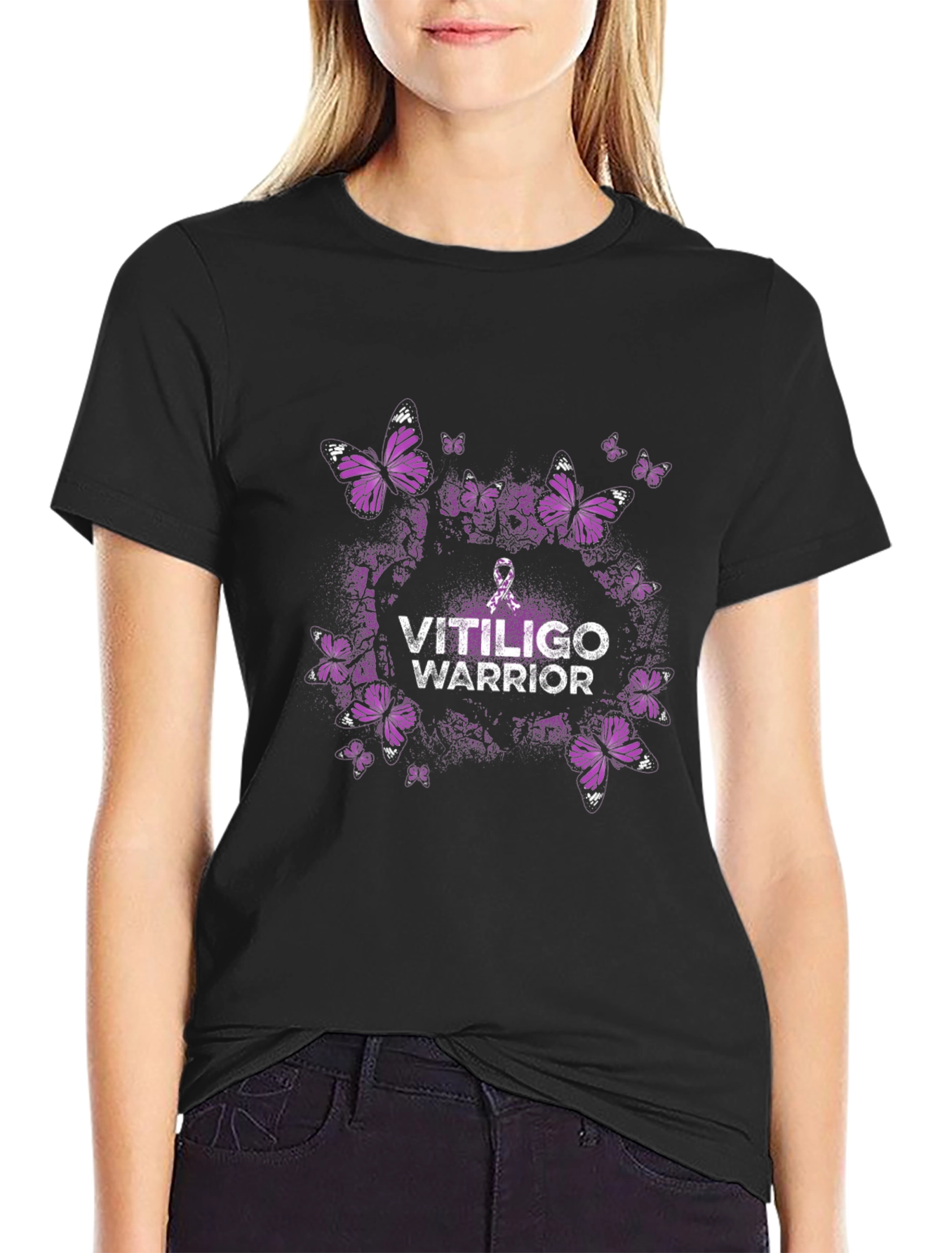 Vitiligo Warrior Butterfly Graphic Tee